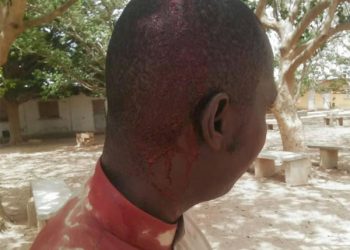 Thiès – Violence scolaire : Un élève frappe son prof avec un morceau de brique