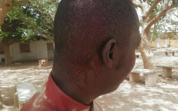 Thiès – Violence scolaire : Un élève frappe son prof avec un morceau de brique